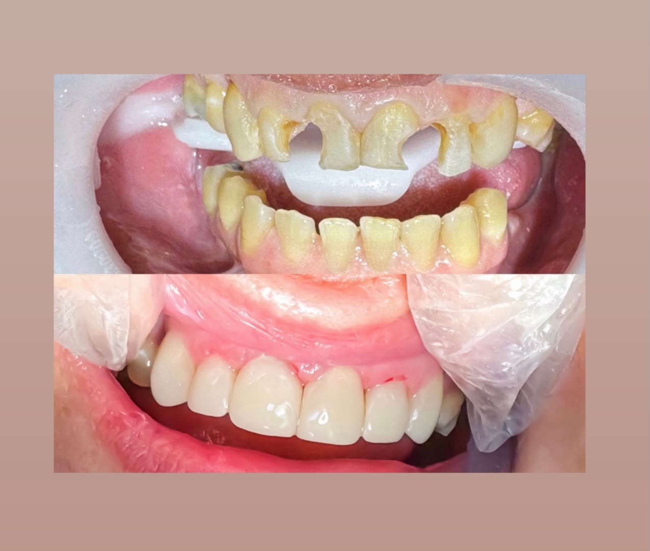 Estética Dental
